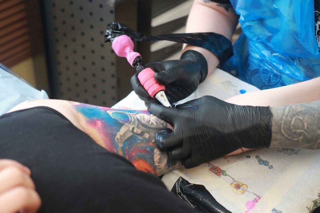 Laser Tattoo Removal  