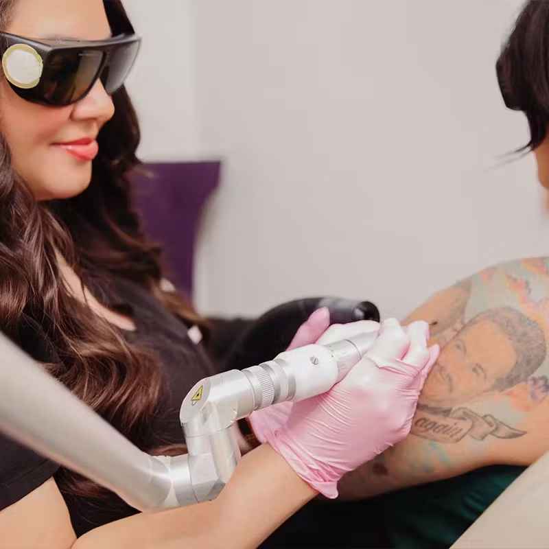 Colorful sleeve tattoo on arm before laser tattoo removal