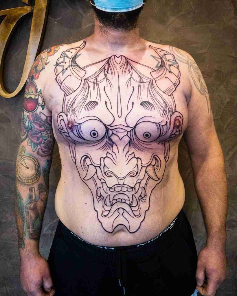 Pete Davidson Tattoo Removal