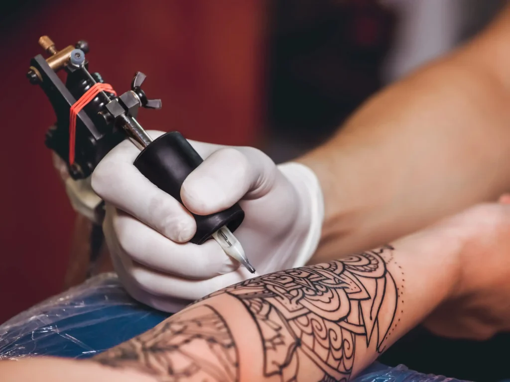 Tattoo Removal Near Me 